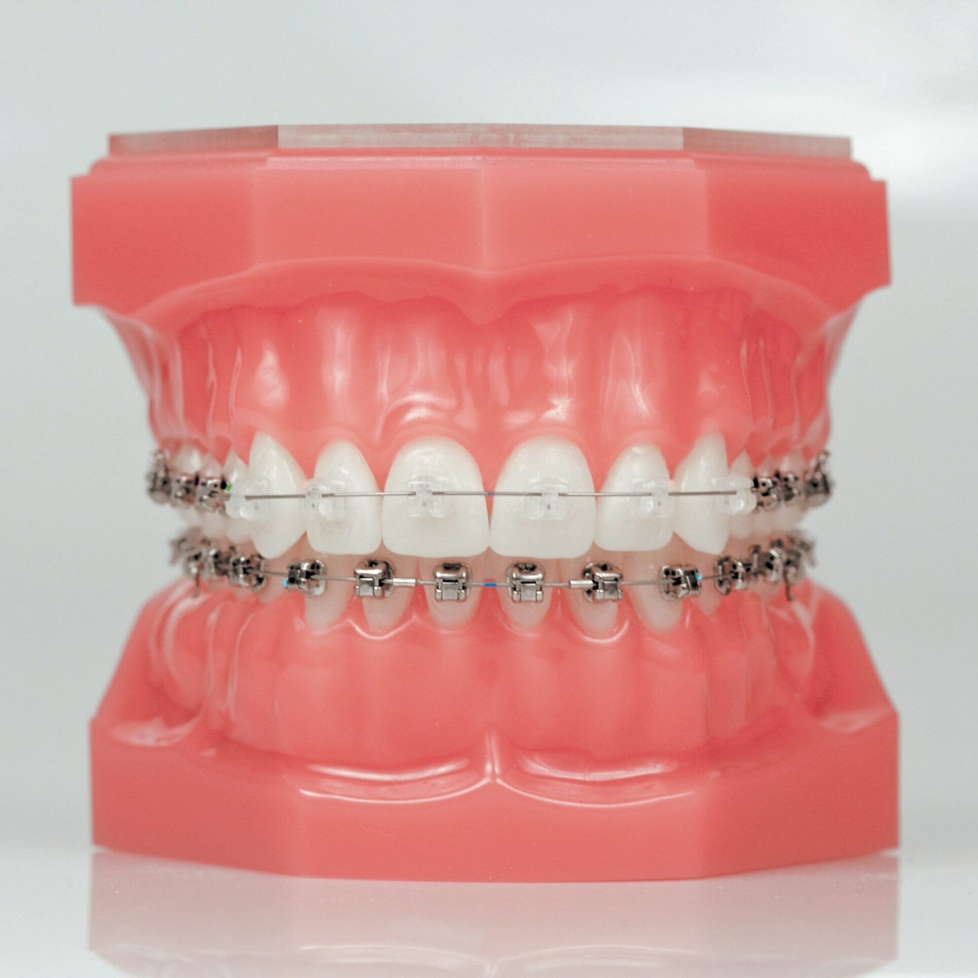 orthodontics westlake